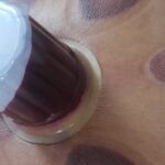 حجامت و زالو درمانی